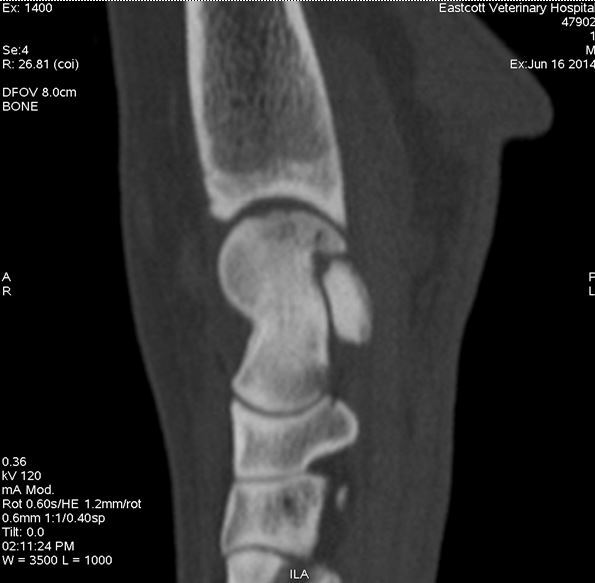 Sagittal image of hock showing OCD lesion of the medial talar ridge